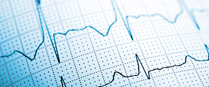 Interpretación de Electrocardiogramas Interpretación de Electrocardiogramas